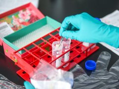亲子鉴定辅助调解家庭纠纷，缓解夫妻间不和