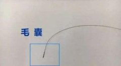 一根头发能验亲？探秘合肥DNA鉴定的“超能力”样本世界